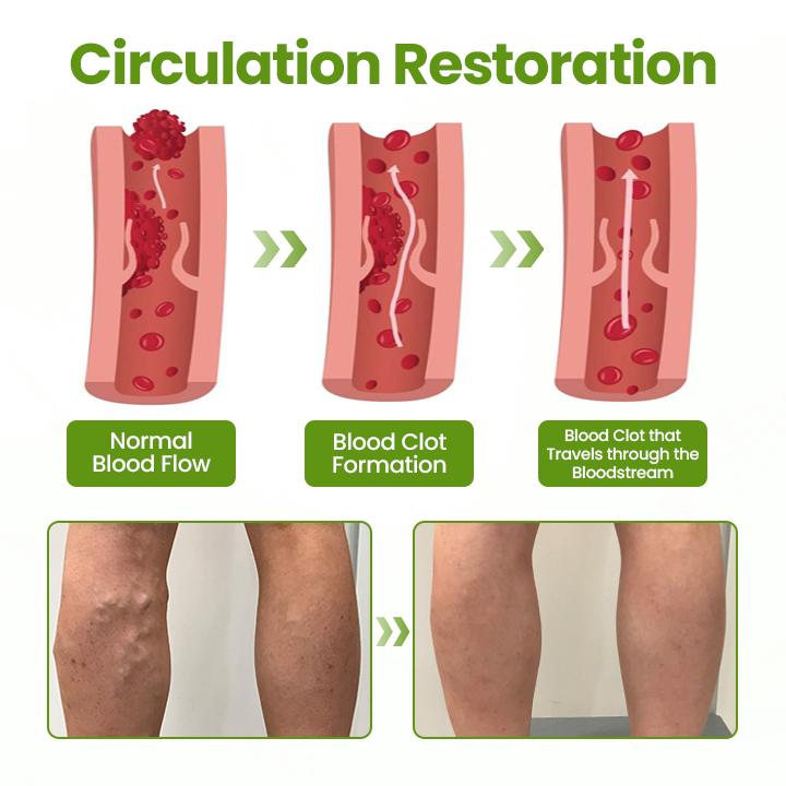 Timilk® VeinEase Leg Mask