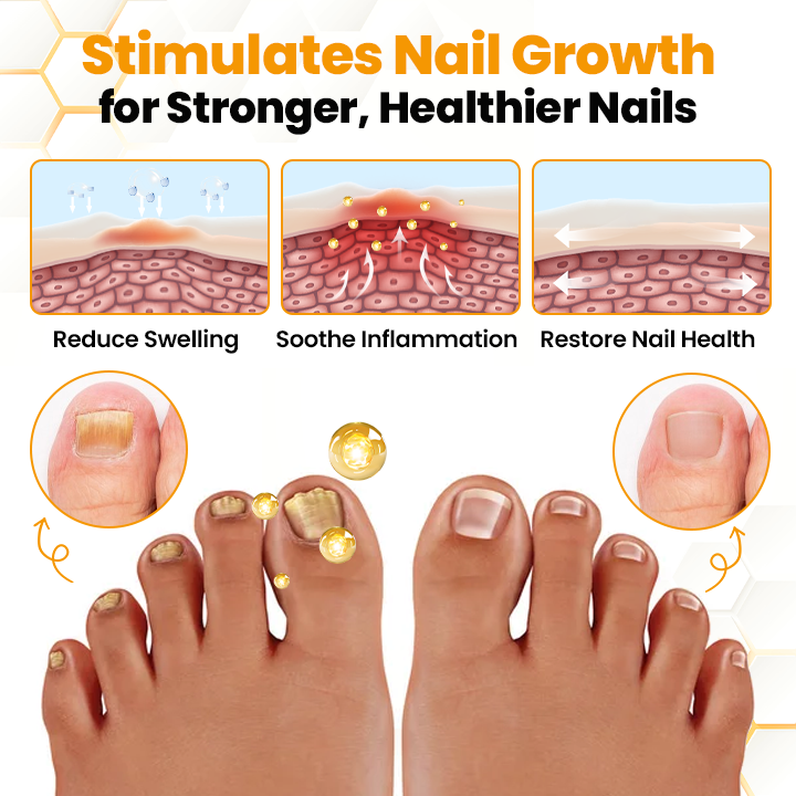 Biancat® BeeVenom Anti-Fungal Nail Renewal Oil