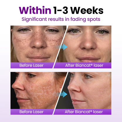 Biancat® SpotErase Probiotic Shield Serum