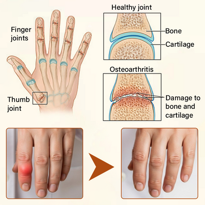 Timilk® VenomEase Joint Cream