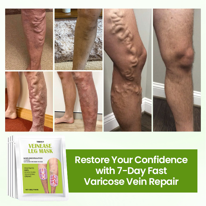 Timilk® VeinEase Leg Mask