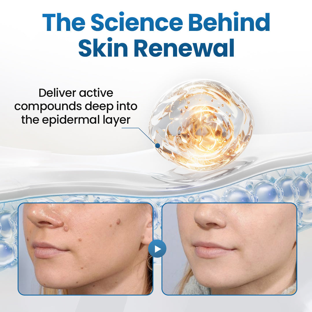 Biancat® BumpFlatten Cream