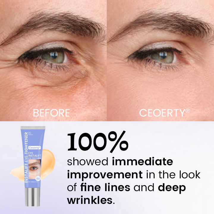 Ceoerty® InstaLift Eye Tightener – 10 Seconds to Younger, Fresher Eyes