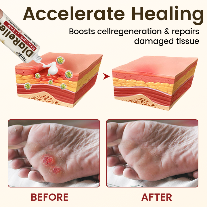 Timilk® DiaRelief Healing Cream