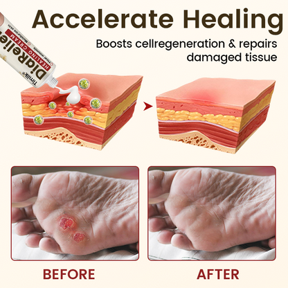 Timilk® DiaRelief Healing Cream