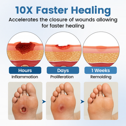 Timilk® AngioVita Diabetic Care Spray