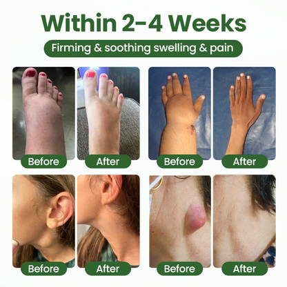 Timilk® BodyRelief Circulation Cream