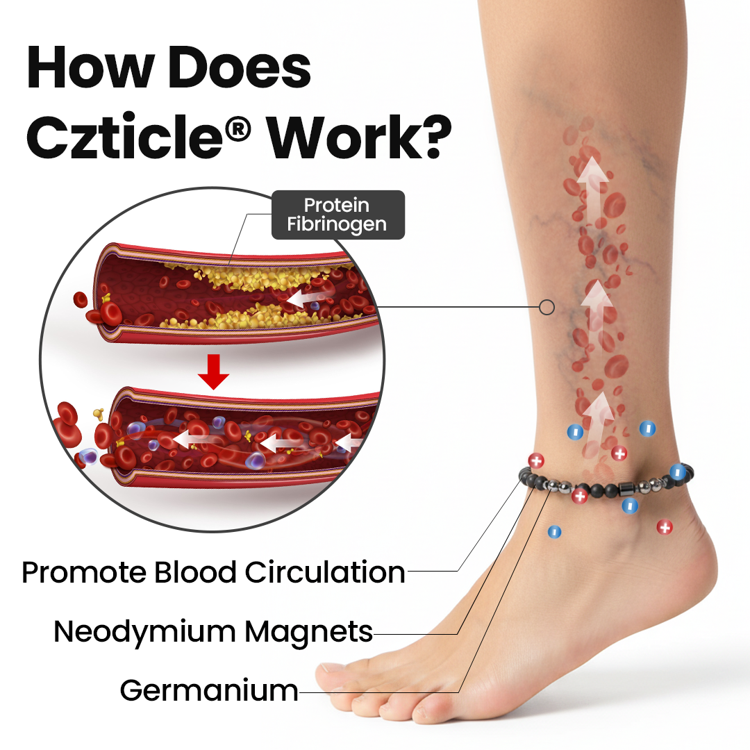 Czticle® Leg Vein Magnet Ankle Bracelet