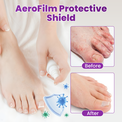 Timilk® AeroFilm Foot Defense Mist