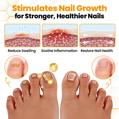 Biancat® BeeVenom Anti-Fungal Nail Renewal Oil