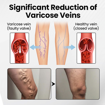 Czticle® Leg Vein Magnet Ankle Bracelet